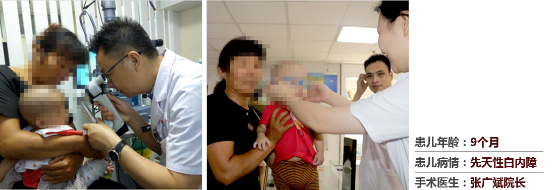 患兒年齡：9個月，患兒病情：先天性白內障，手術醫(yī)生：張廣斌院長
